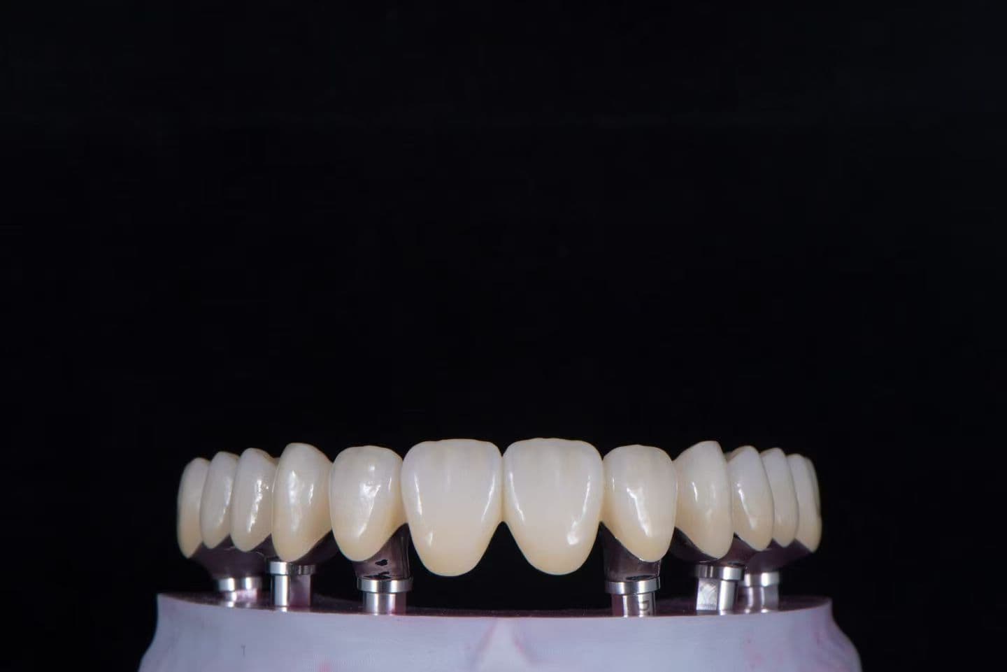 Full-arch zirconia